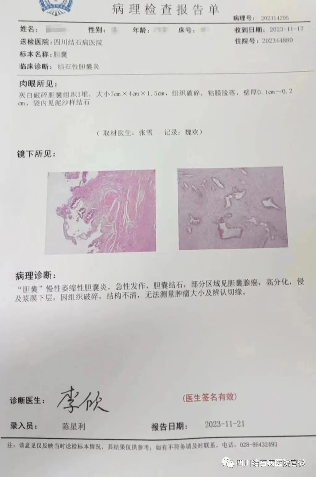 胆结石拖一拖无所谓？四川保胆取石专家：那是你没见识到它的“杀伤力”(图1)