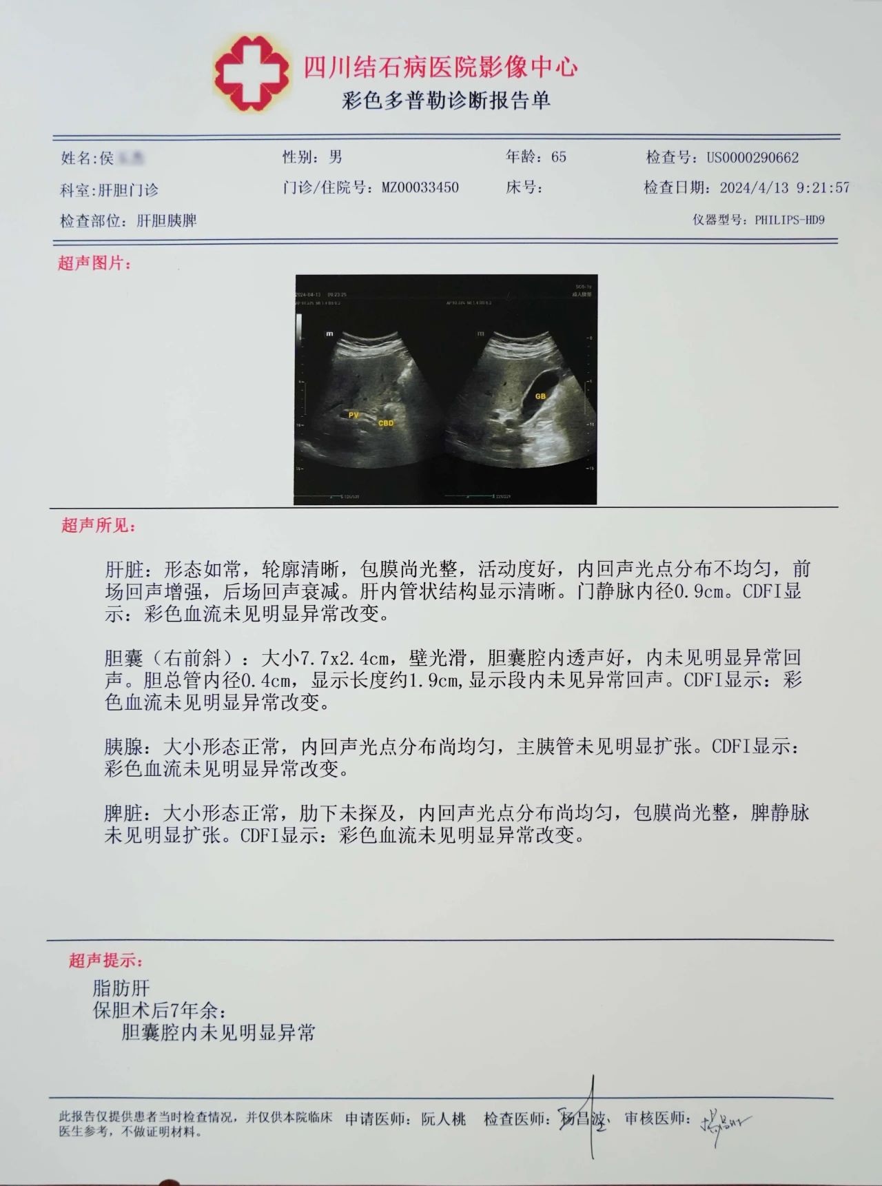 四川保胆医院对话保胆者:保胆术后多年,他们返院复查时说……(图3) 四川保胆医院对话保胆者:保胆术后多年,他们返院复查时说……(图3)