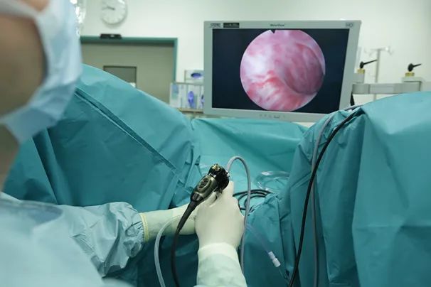 四川瑞梦热蒸汽消融术:3分钟解决长达七年之久的前列腺增生问题(图2) 四川瑞梦热蒸汽消融术:3分钟解决长达七年之久的前列腺增生问题(图2)