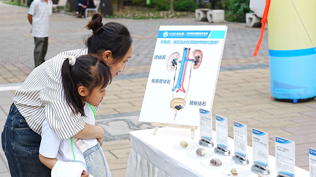 结石萌医上岗记：走进青白江红河社区，“医”起探秘结石！(图3)