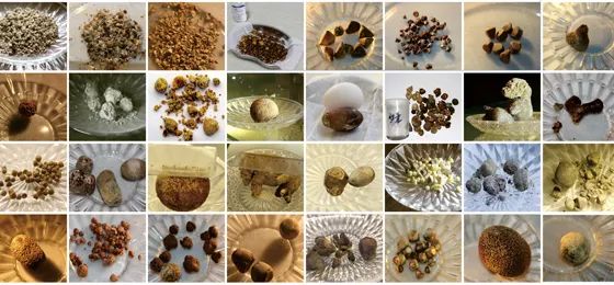 发现胆结石,为什么建议要尽早处理?何明刚主任详解四大核心原因!【四川胆结石专科医院】(图2) 发现胆结石,为什么建议要尽早处理?何明刚主任详解四大核心原因!【四川胆结石专科医院】(图2)