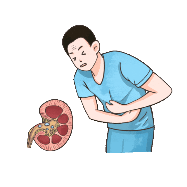 为什么有的人结石不痛,一查却很严重?四川结石病医院泌尿外科孙剑鸿主任详解(图2) 为什么有的人结石不痛,一查却很严重?四川结石病医院泌尿外科孙剑鸿主任详解(图2)