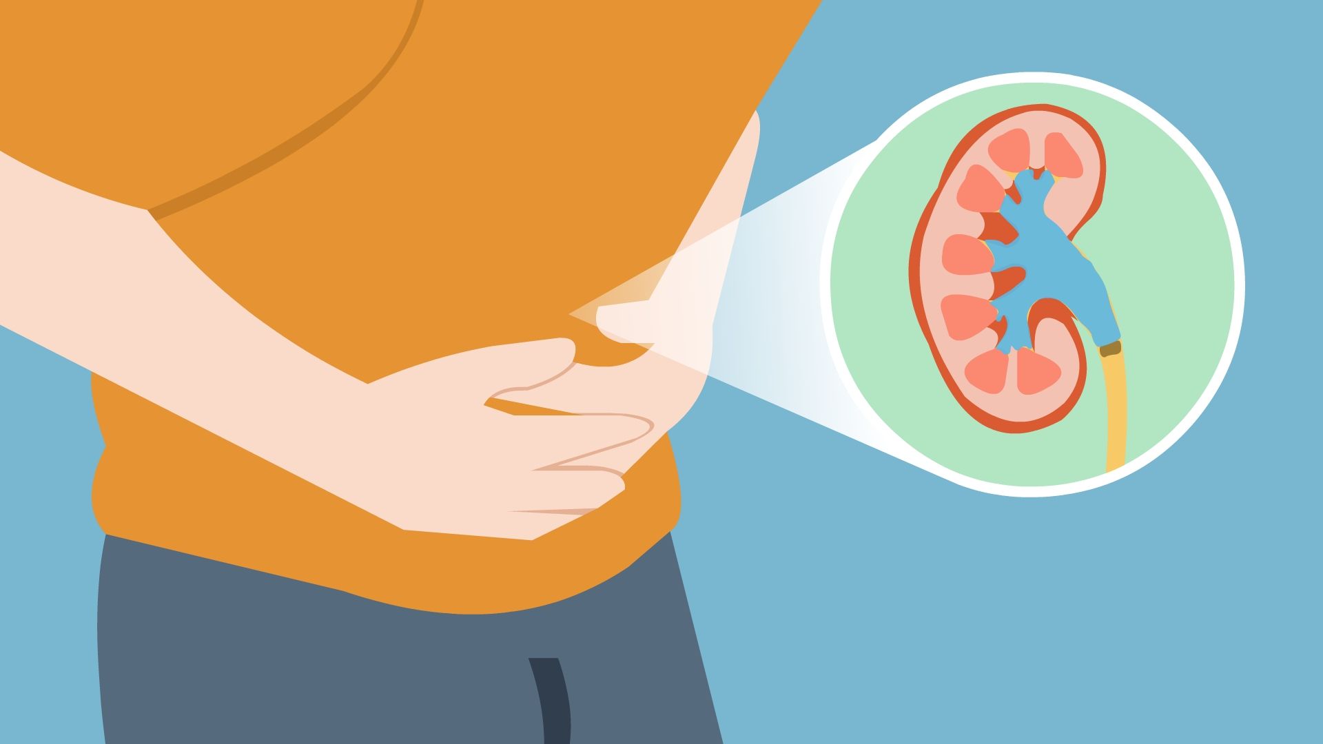 引起肾结石的主要原因是什么?一定要注意这几个习惯!【四川结石病医院】(图2) 引起肾结石的主要原因是什么?一定要注意这几个习惯!【四川结石病医院】(图2)