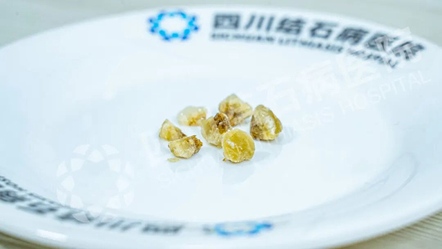 胆好壮壮，人超棒棒：“隐痕保胆”术后，退休教师赠童趣锦旗(图2)