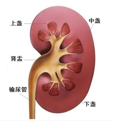 体检查出肾结石，别慌！先搞懂这3件事，少走弯路不遭罪【四川结石病医院】(图3)