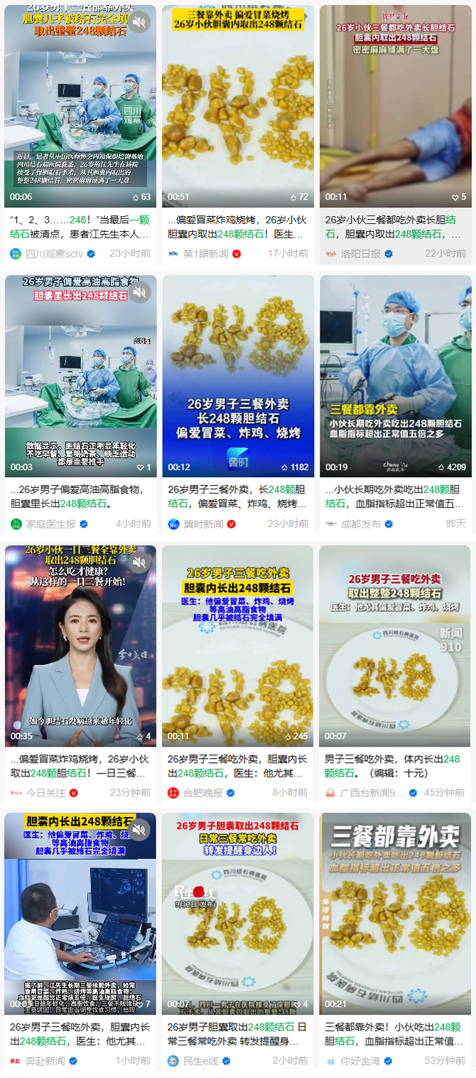 触目惊心！26岁上班族胆囊取出248颗结石，元凶竟是日常外卖(图1)